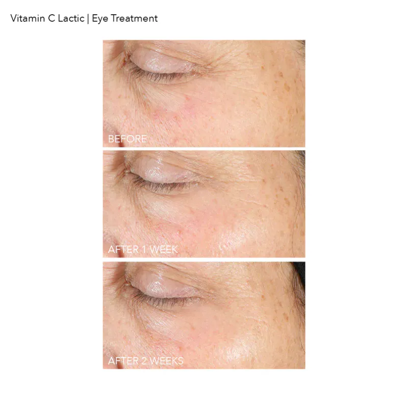 Dr Dennis Gross Firm & Bright Eye Treatment Cream
